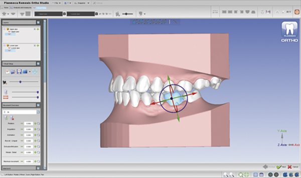 not enough memory to open romexis 3d file
